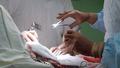Больница заплатит 118 тыс руб пациенту, в чьем теле забыли салфетку
